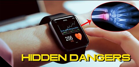 The Hidden Dangers of Smart Watches