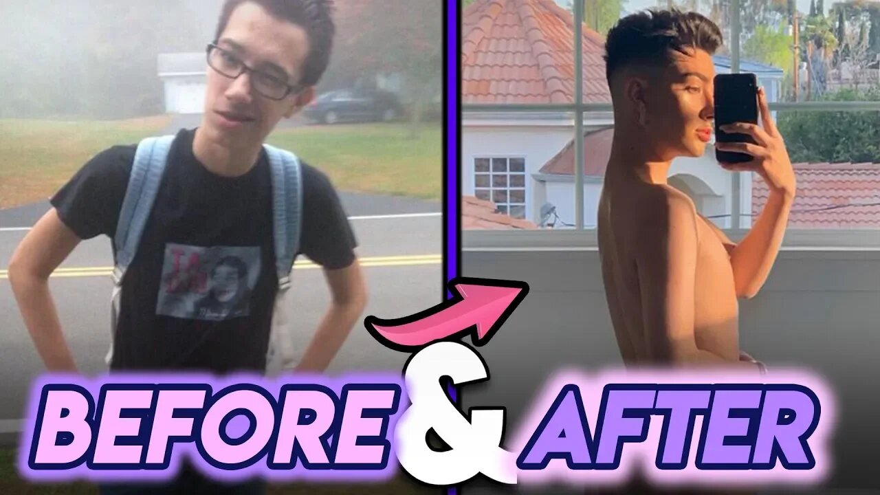 James Charles | Before and After | Butt Implants ? Plastic Surgery Rumours & more