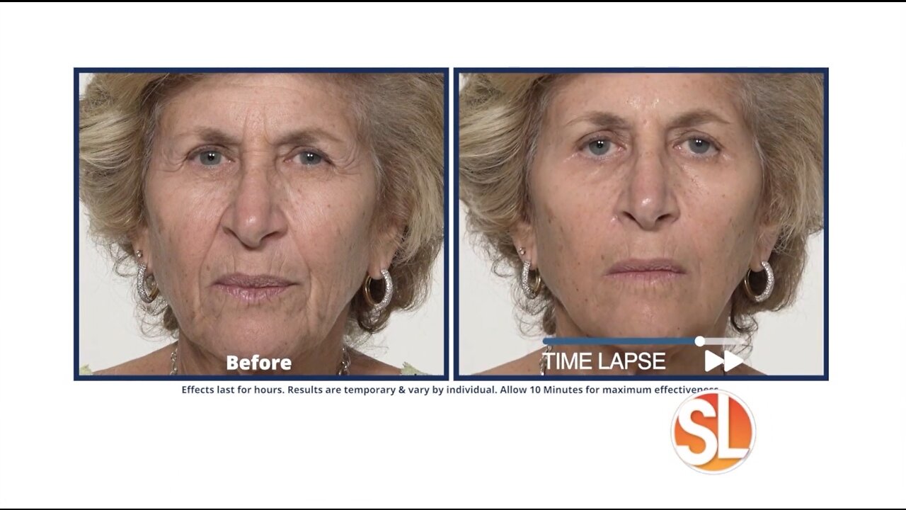 Have you taken the Plexaderm 10-minute challenge to shrink under-eye bags and wrinkles?