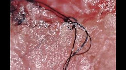 test pcr = parasite = dangers