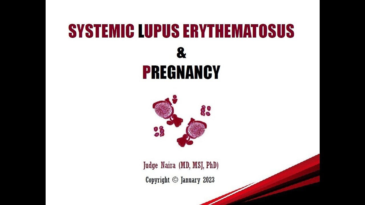 SYSTEMIC LUPUS ERYTHEMATOSUS in Pregnancy