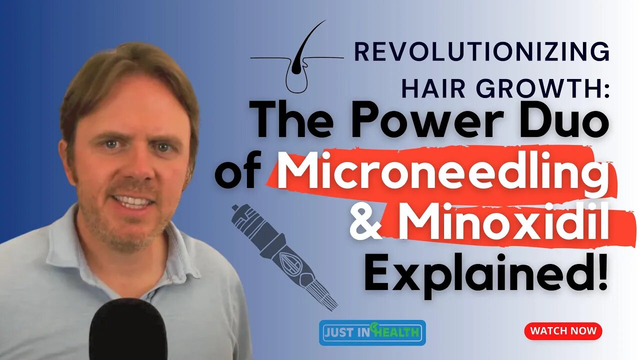 Revolutionizing Hair Growth: The Power Duo of Microneedling & Minoxidil Explained!