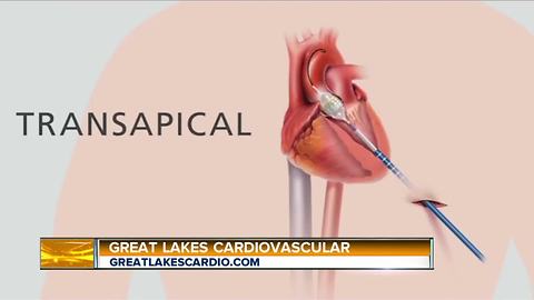 Great Lakes Cardiovascular