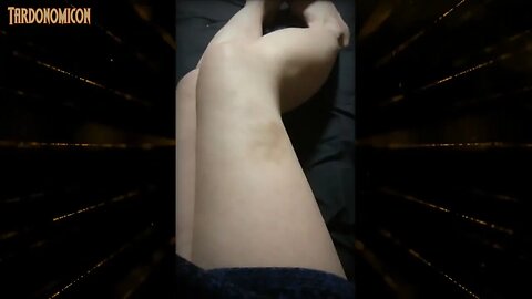 2022 06 17 11 fake punches leave fake bruises