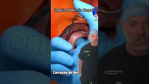 Shocking Hernia Repair 😱 #shorts