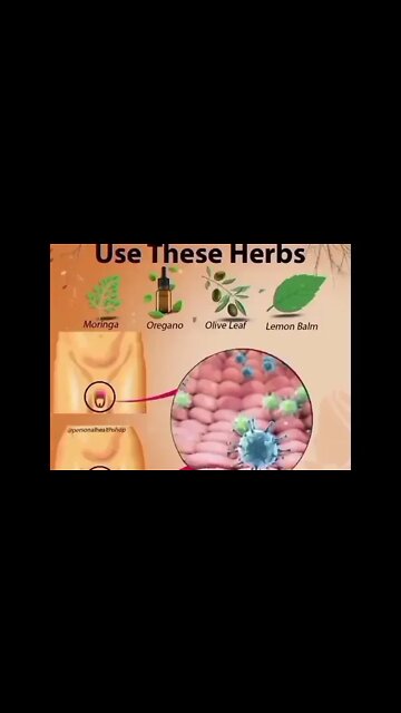 Natural herpes cure get your herbal medicine to cure herpes WhatsApp ‪+234 814 017 5142‬ #drsebi #us