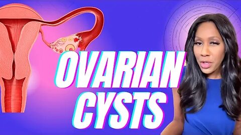 What Are the Symptoms of Ovarian Cysts? What Are Treatments for Ovarian Cysts? A Doctor Explains