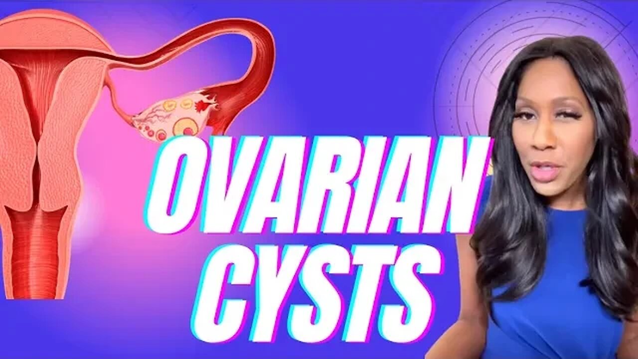 What Are the Symptoms of Ovarian Cysts? What Are Treatments for Ovarian Cysts? A Doctor Explains