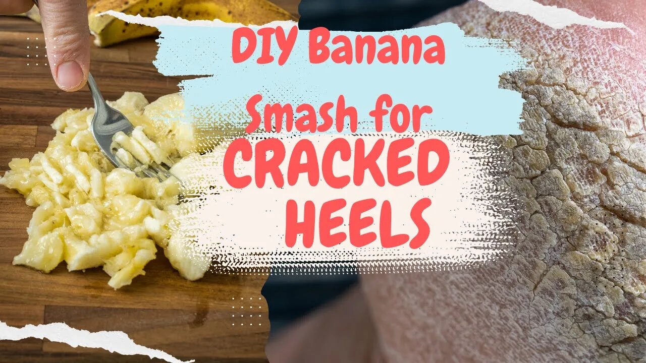 "Cracked Heels? Try This DIY Banana Smash Treatment - Easy & Effective!"