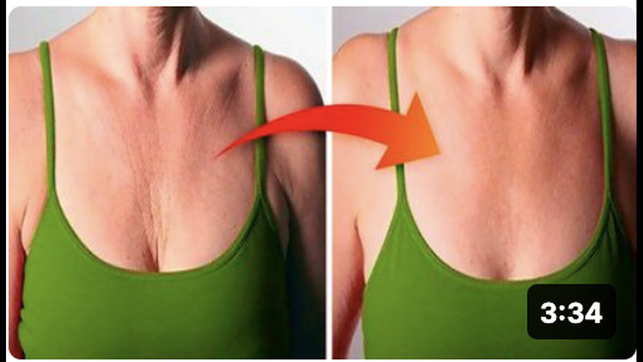 How to Get Rid of Chest and Neck Wrinkles Naturally