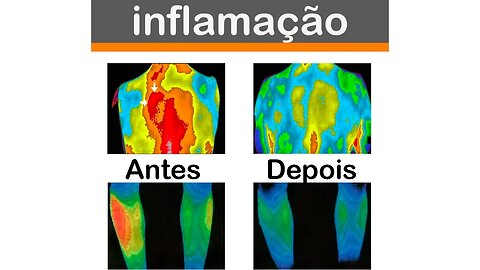 Antioxidante eletrônico reduz a viscosidade do sangue.