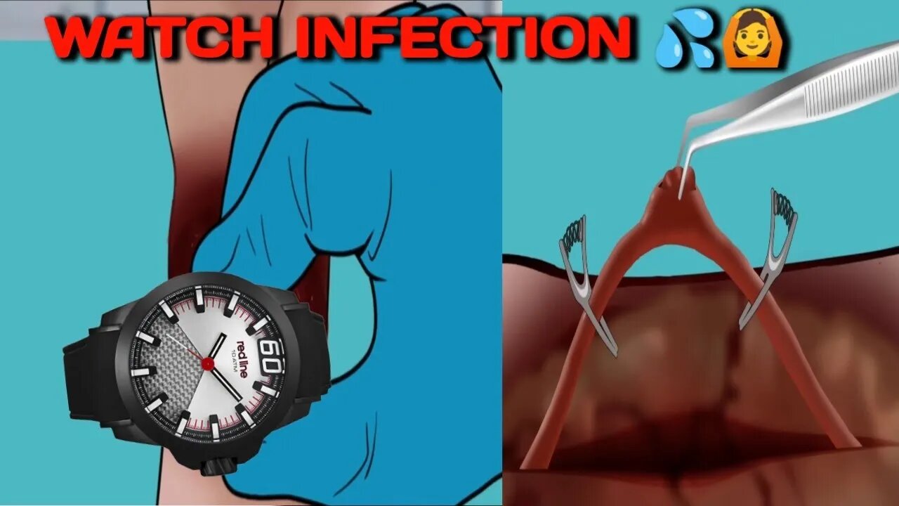 Be Careful Infected For WATCH //ASMR animation//Don't Were Tight Watch//@uttam6361