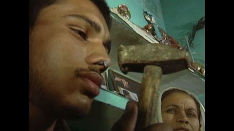 Man Hammers Nail Into Nostril