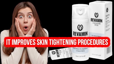 Revamin Stretch Mark - revamin stretch mark review : say goodbye to stretch marks