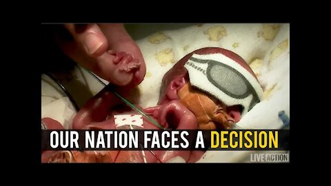 America faces a decision: Will we protect life?