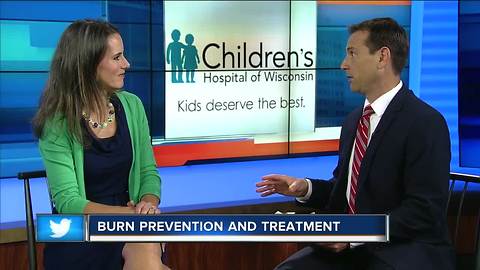 Treating burns in children and teensll nice