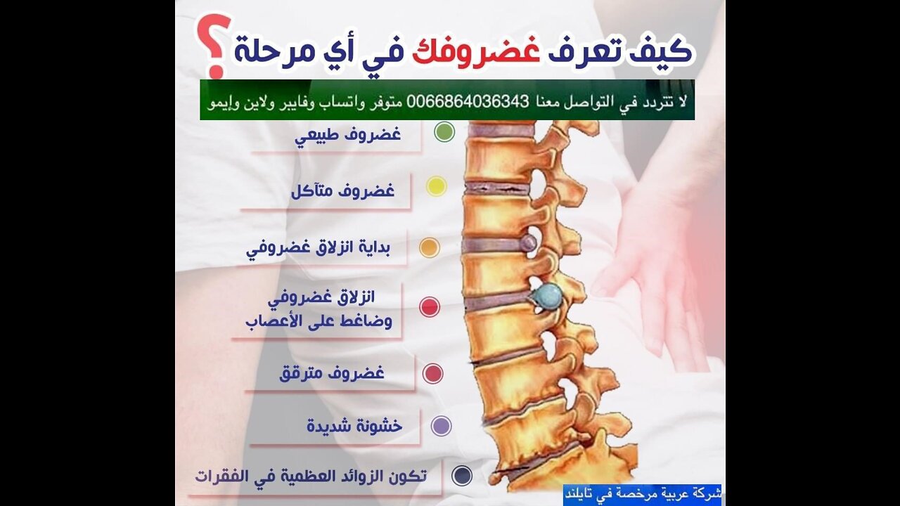 علاج العمود الفقري والإنزلاق الغضروفي بدون جراحة - علاج الديسك بالليزر في تايلاند