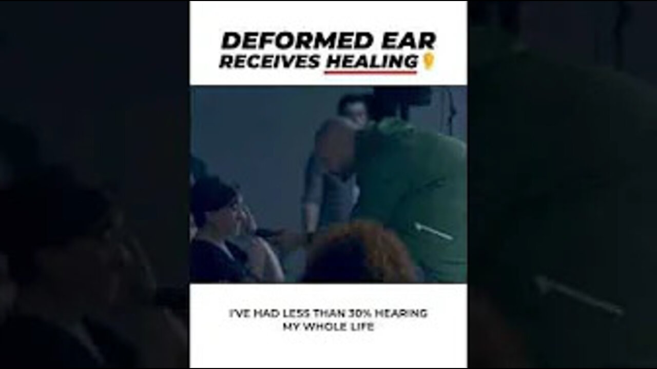 Deformed Ear Receives Healing 👂 #shorts