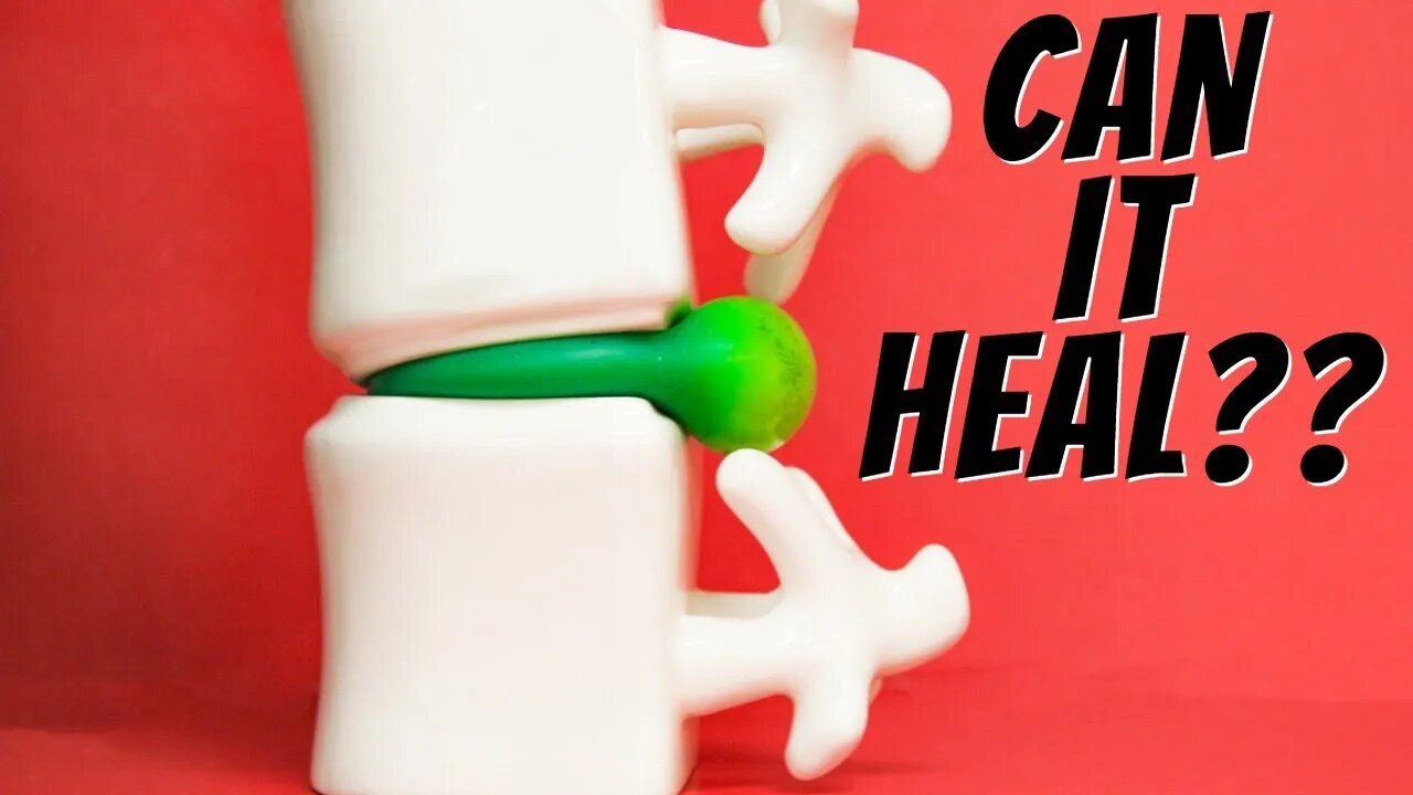 Can My Herniated , Bulging Disc or Sciatica Heal, How Long