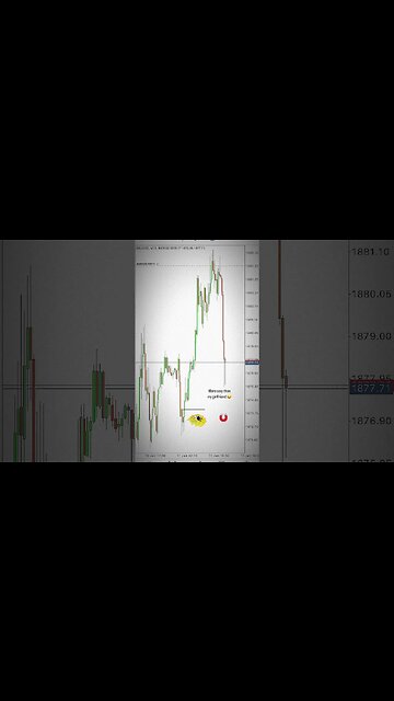 XAUSD TRADE 22k #forex