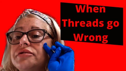 When Threads go WRONG?????