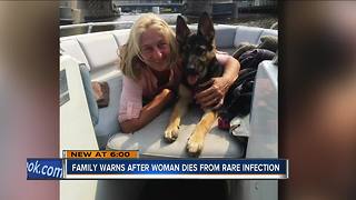 Wisconsin woman dies after dog lick