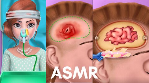 Brain Surgery Animation ASMR - Brain Injury