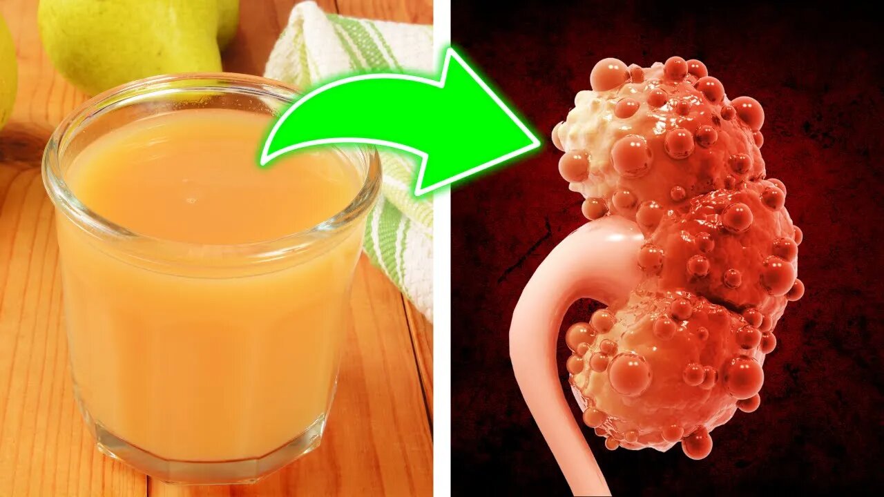 One Cup In The Morning To Purify Your Kidneys and Cleanse Toxins From the Body