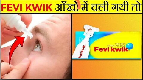 FeviKwik आँखों में चला जाए तो क्या होगा??😨