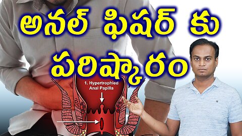 అనల్ ఫిషర్ కు పరిష్కారం, Anal Fissure Treatment cure English | డా. భరద్వాజ్ | హోమియోపతి