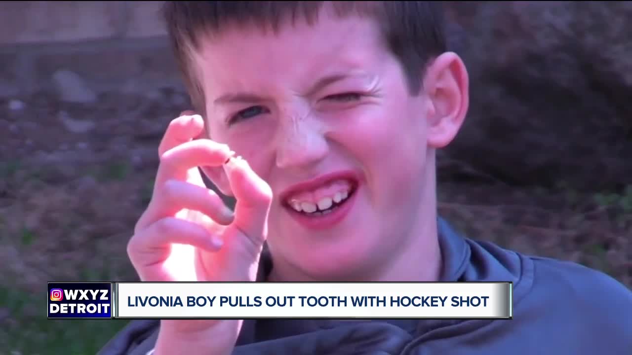 Eight-year-old Livonia hockey player pulls out tooth with shot