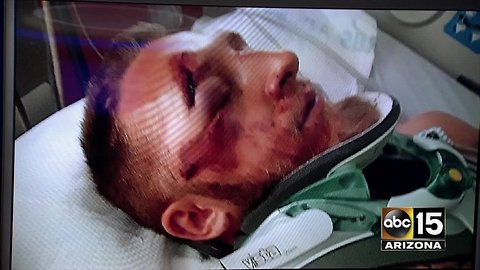Phoenix biker says pothole landed him in the ICU