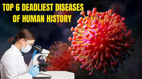 Top 6 Deadliest Diseases Of Human History || Urdu/Hindi Information || InfologicalTV