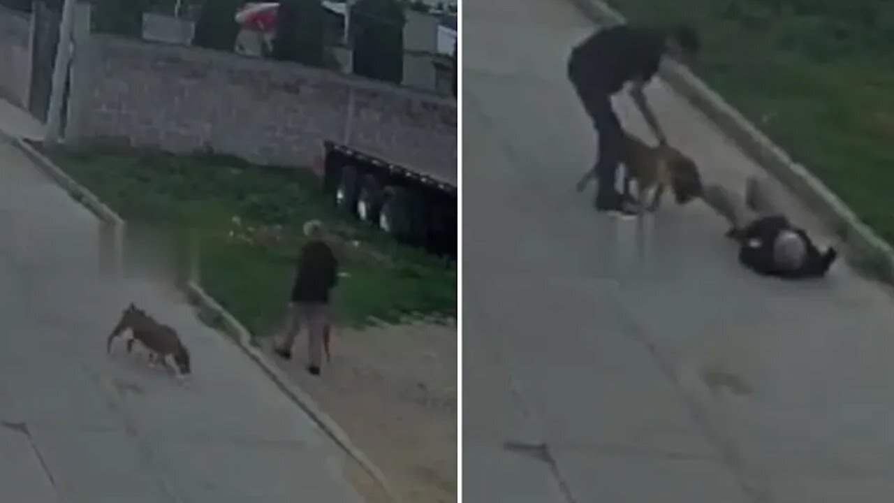 Mujer termina con las piernas destrozadas tras ataque de un perro en Santiago Tulantepec, Hidalgo