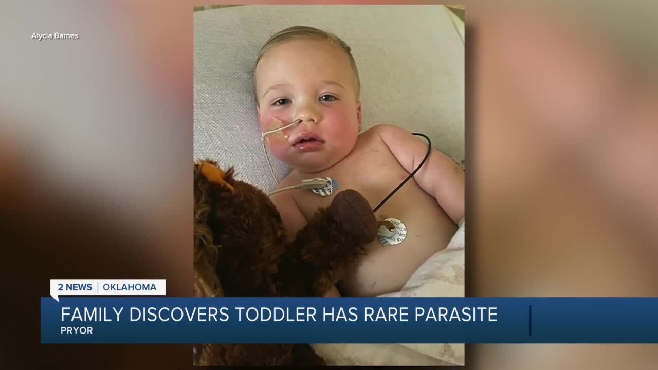 Family Discovers Toddler Has Rare Parasite