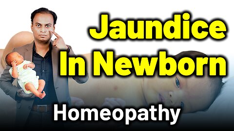 Jaundice in Born Baby,Physiological Neonatal Jaundice | Dr.Bharadwaz | Homeopathy,Treatment & Cure