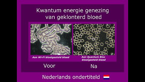 Spectaculaire verbetering van het bloedbeeld door kwantum energie technologie