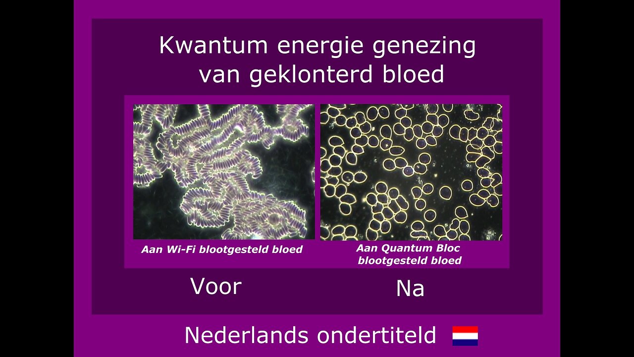 Spectaculaire verbetering van het bloedbeeld door kwantum energie technologie