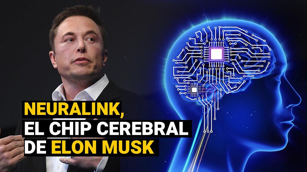 Primer Hombre Con CHIP Cerebral de Elon Musk