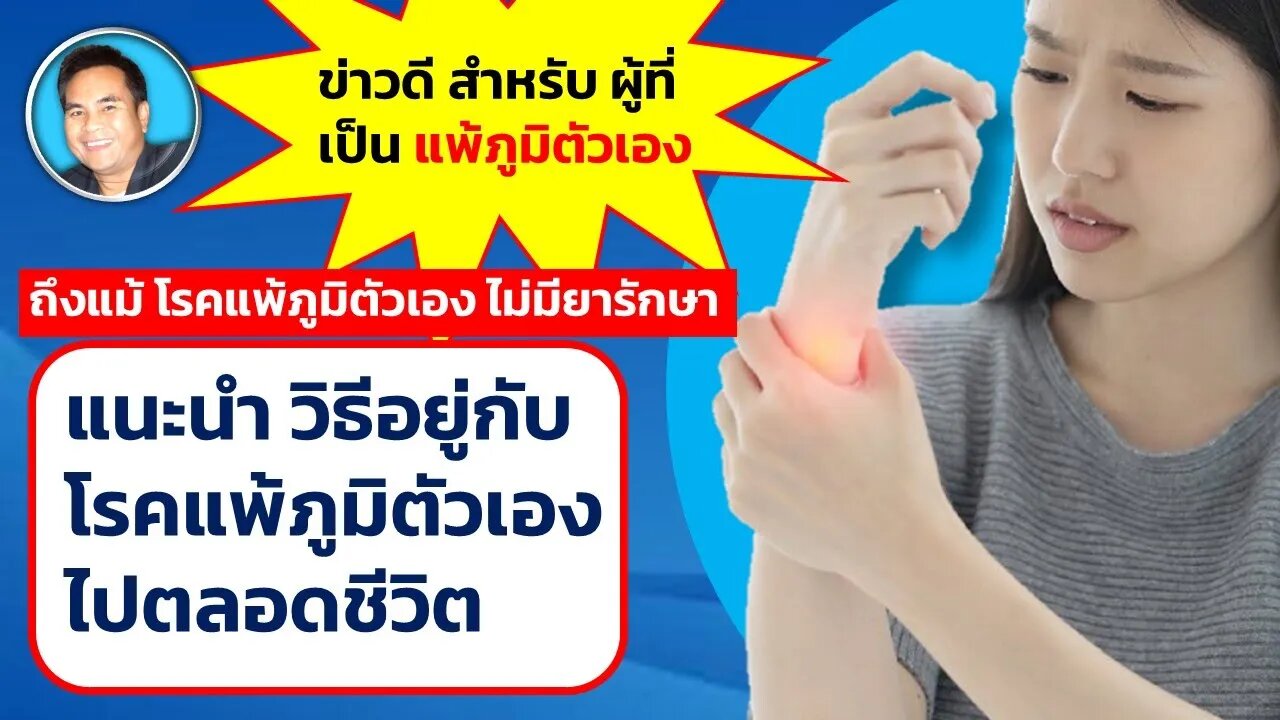 วิธีที่ดีที่สุด ที่จะอยู่กับโรค #แพ้ภูมิตัวเอง ไปตลอดชีวิต