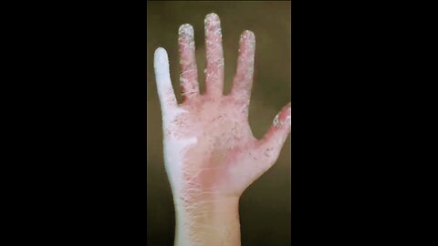 A brick of dry ice do to your body