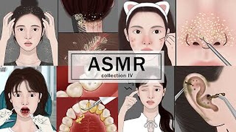 SATISFYING I ASMR Scalp Scaling