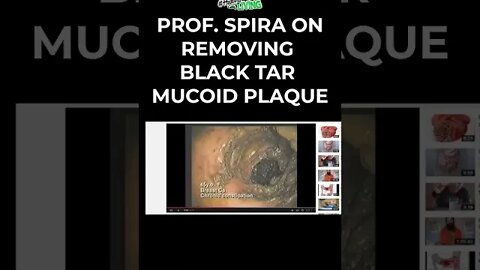 LEARN TO REMOVE BLACK TAR MUCOID PLAQUE #shorts