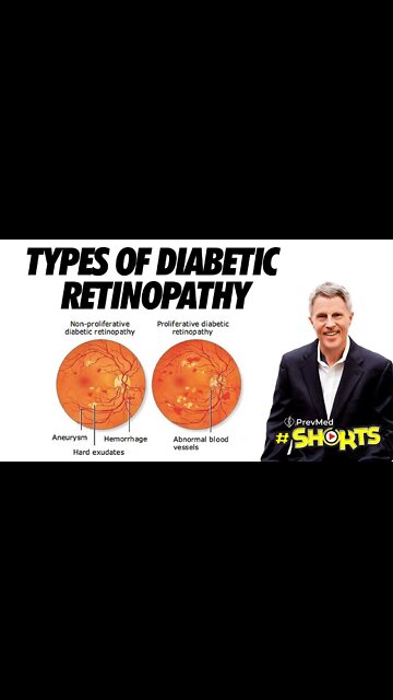 #SHORTS Types of Diabetic Retinopathy