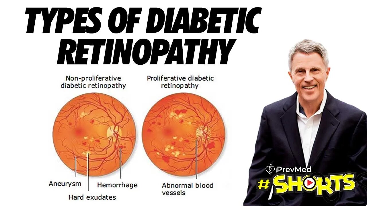 #SHORTS Types of Diabetic Retinopathy