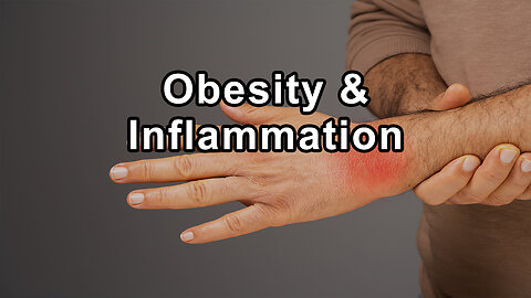 Dr. Jyothi Rao Discusses Obesity and Its Contribution to Inflammation, Epigenetic Changes, and