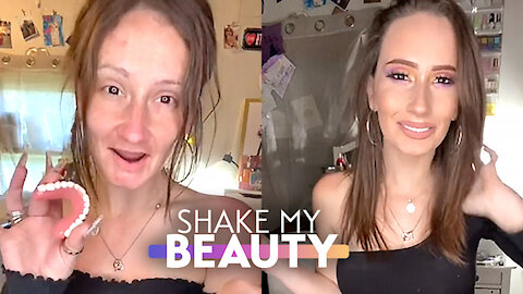 I'm Accused Of Catfishing Cos I Have No Teeth | SHAKE MY BEAUTY