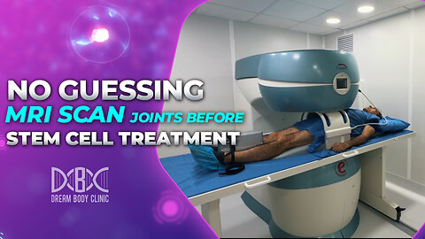 No guessing - MRI Scan Joints Before Stem Cell Treatment
