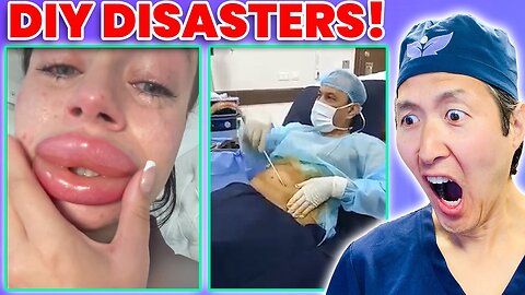 Plastic Surgeon Reacts to UNHINGED DIY Plastic Surgery TikToks!