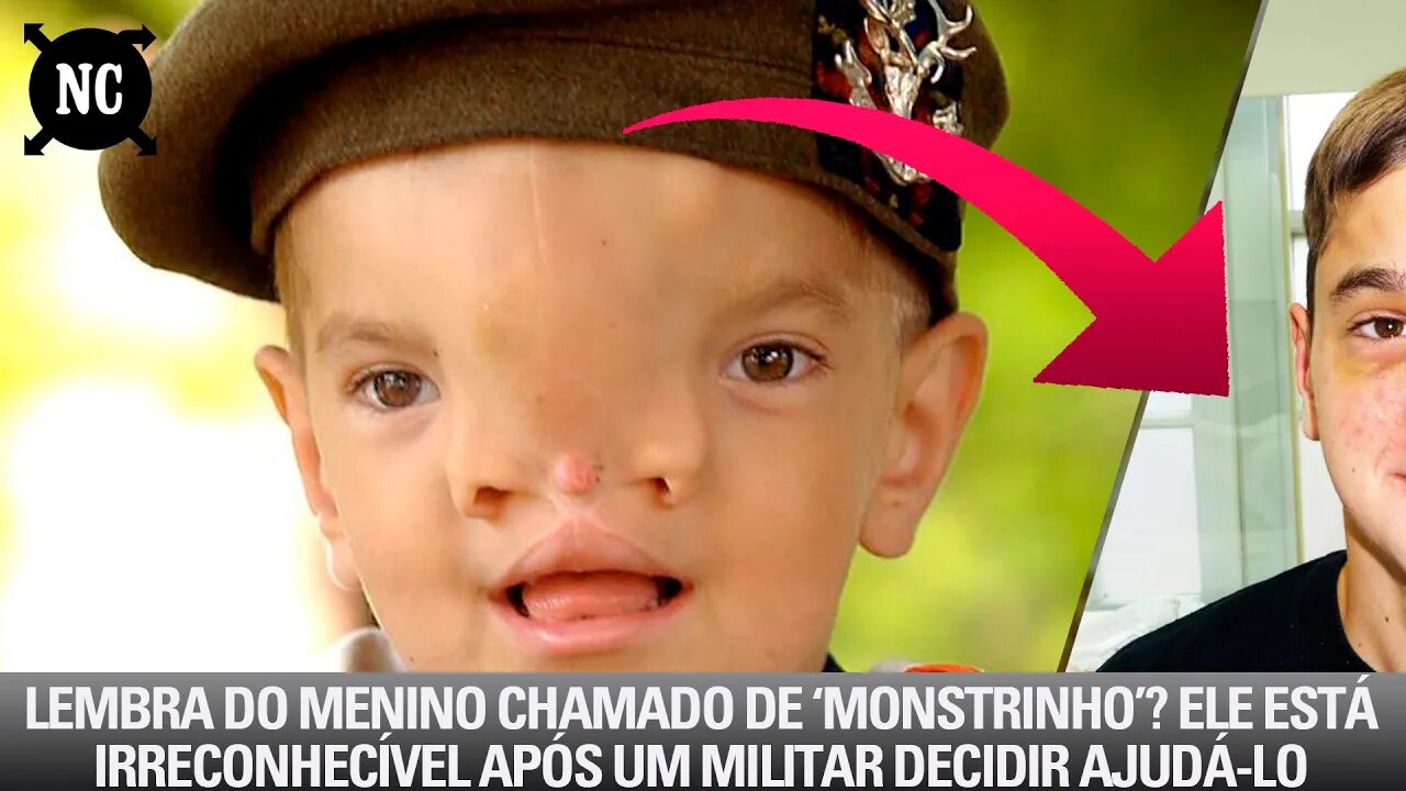 Lembra Do Menino Chamado De ‘Monstrinho’? Ele Está Irreconhecível Após Um Militar Decidir Ajudá-lo